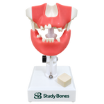 Premolar Dental Model with Impacted Third Molar and Gingiva