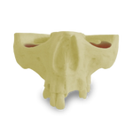 Maxilla with Teeth 11, 12, 14, 18, 24, 26 and 27