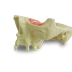 Maxilla with Teeth 11, 12, 14, 18, 24, 26 and 27