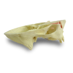 Maxilla with Teeth 11, 12, 14, 18, 24, 26 and 27