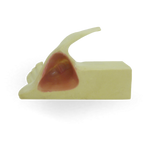Maxillary Sinus with Support Block