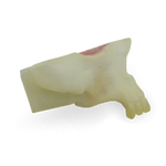 Maxillary Sinus with Support Block