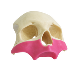 All-on-4® Zygoma Frontal Skull with Gingiva