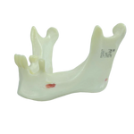 Mandible with Partial Dentition