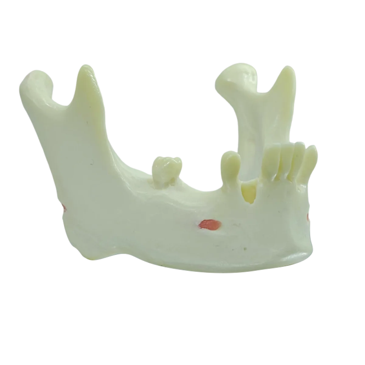 Mandible with Partial Dentition