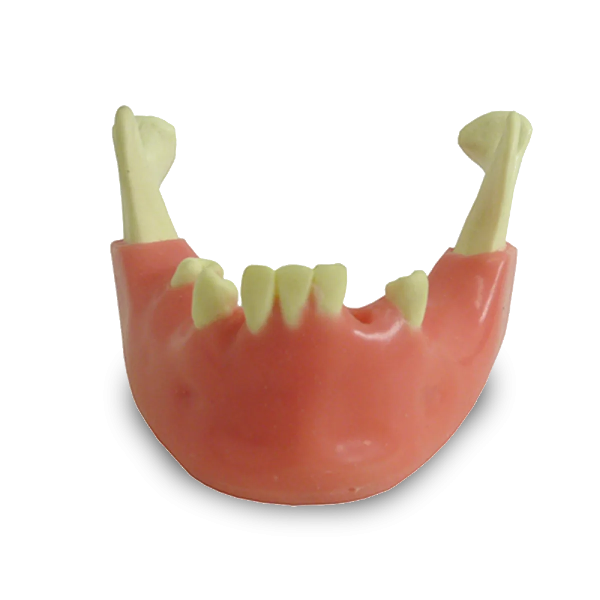 Mandible with Partial Dentition and Gingiva