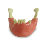 Mandible with Partial Dentition and Gingiva