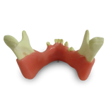 Mandible with Partial Dentition and Gingiva
