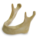 Extra-hard Edentulous Mandible