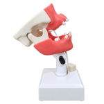 Premolar Dental Model with Impacted Third Molar and Gingiva
