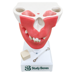 Premolar Dental Model with Impacted Third Molar and Gingiva