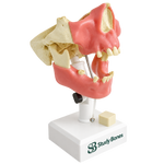 Premolar Dental Model with Gingiva