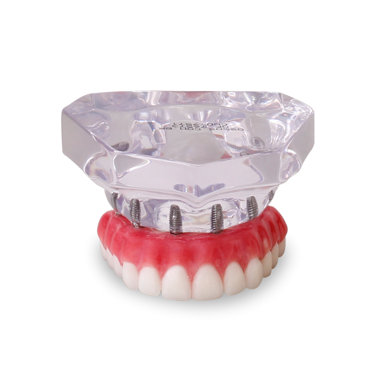 Acrylic Maxilla with 6 Implants and Full-arch Prosthesis