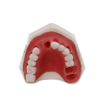 Periodontal Maxilla