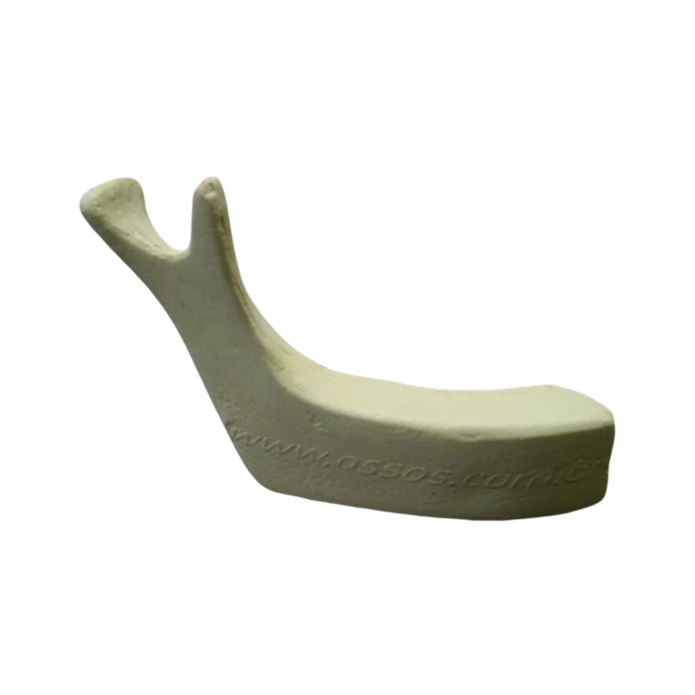 Right Edentulous Hemimandible