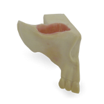 Maxillary Sinus with Support Block