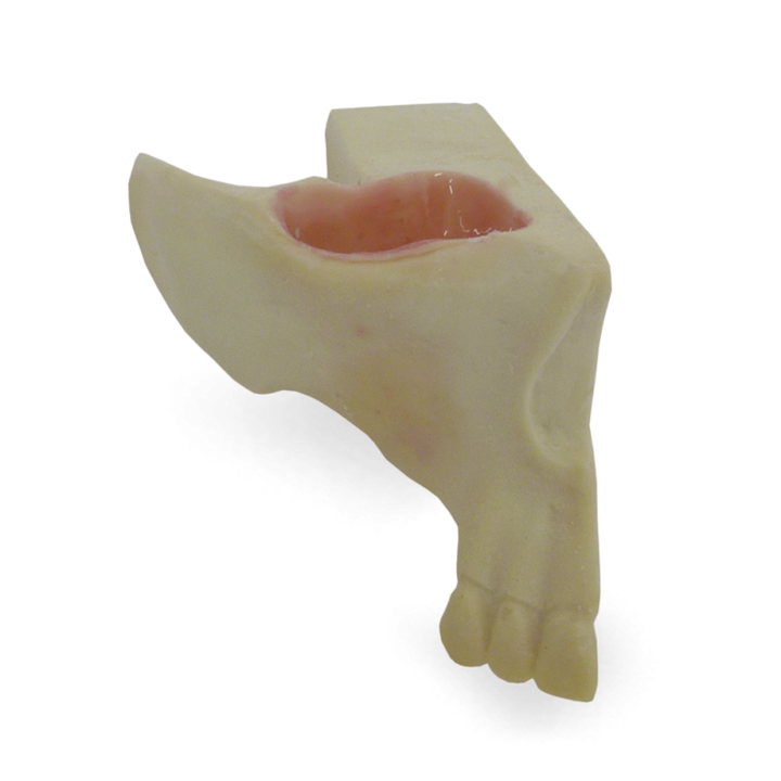 Maxillary Sinus with Support Block