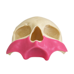 All-on-4® Zygoma Frontal Skull with Gingiva