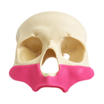 All-on-4® Zygoma Frontal Skull with Gingiva