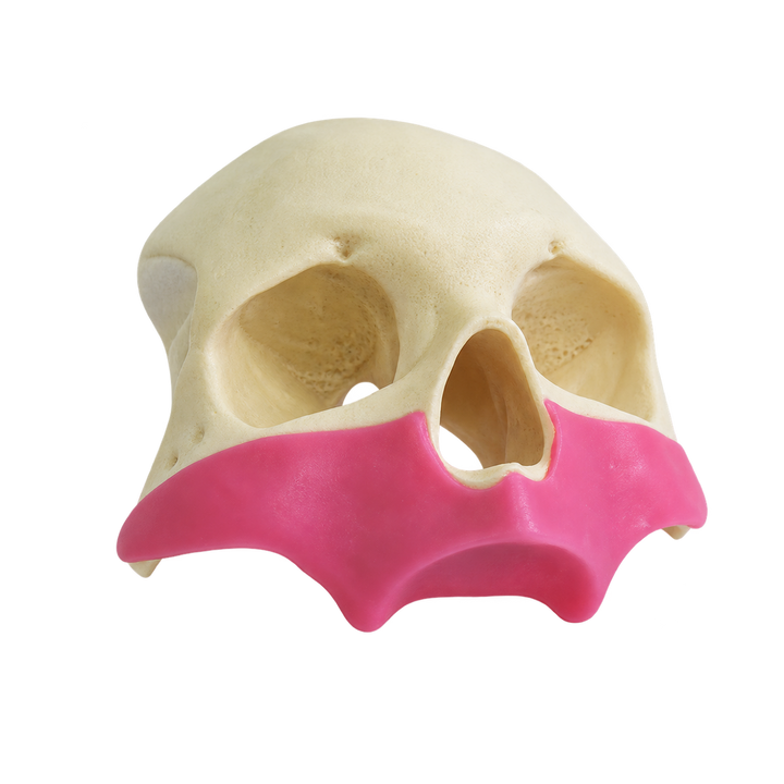 All-on-4® Zygoma Frontal Skull with Gingiva
