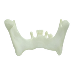 Mandible with Partial Dentition