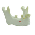 Mandible with Partial Dentition