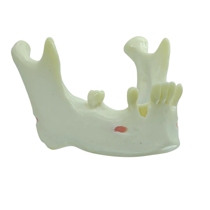 Mandible with Partial Dentition