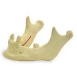 Mandible with Canines and Left Second Molar