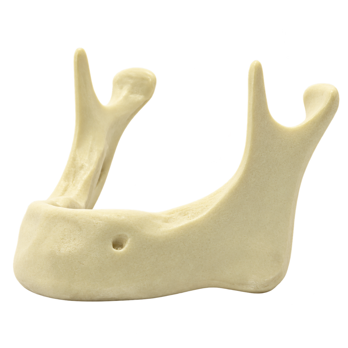 Edentulous Mandible