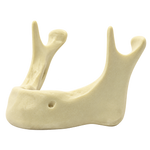 Edentulous Mandible