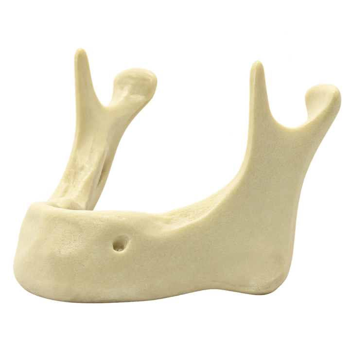 Edentulous Mandible
