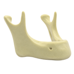 Edentulous Mandible