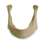 Extra-hard Edentulous Mandible