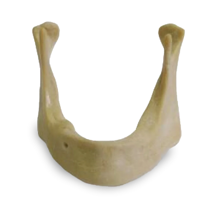 Extra-hard Edentulous Mandible